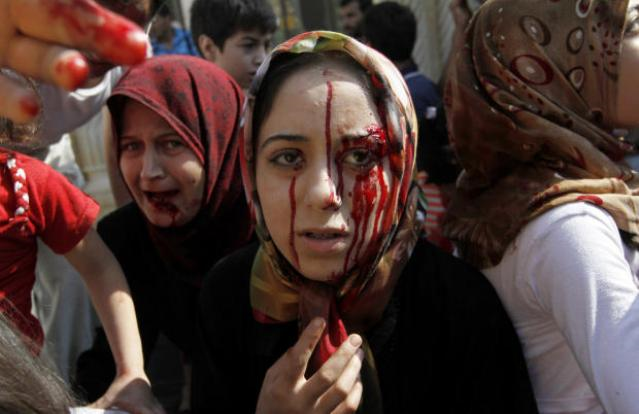 Syria - Woman with bloody face from Chemical Weapons attack